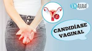 CandidaseVaginaloquesintomasdiagnsticotratamentoepreveno_0012095001740263402.jpeg