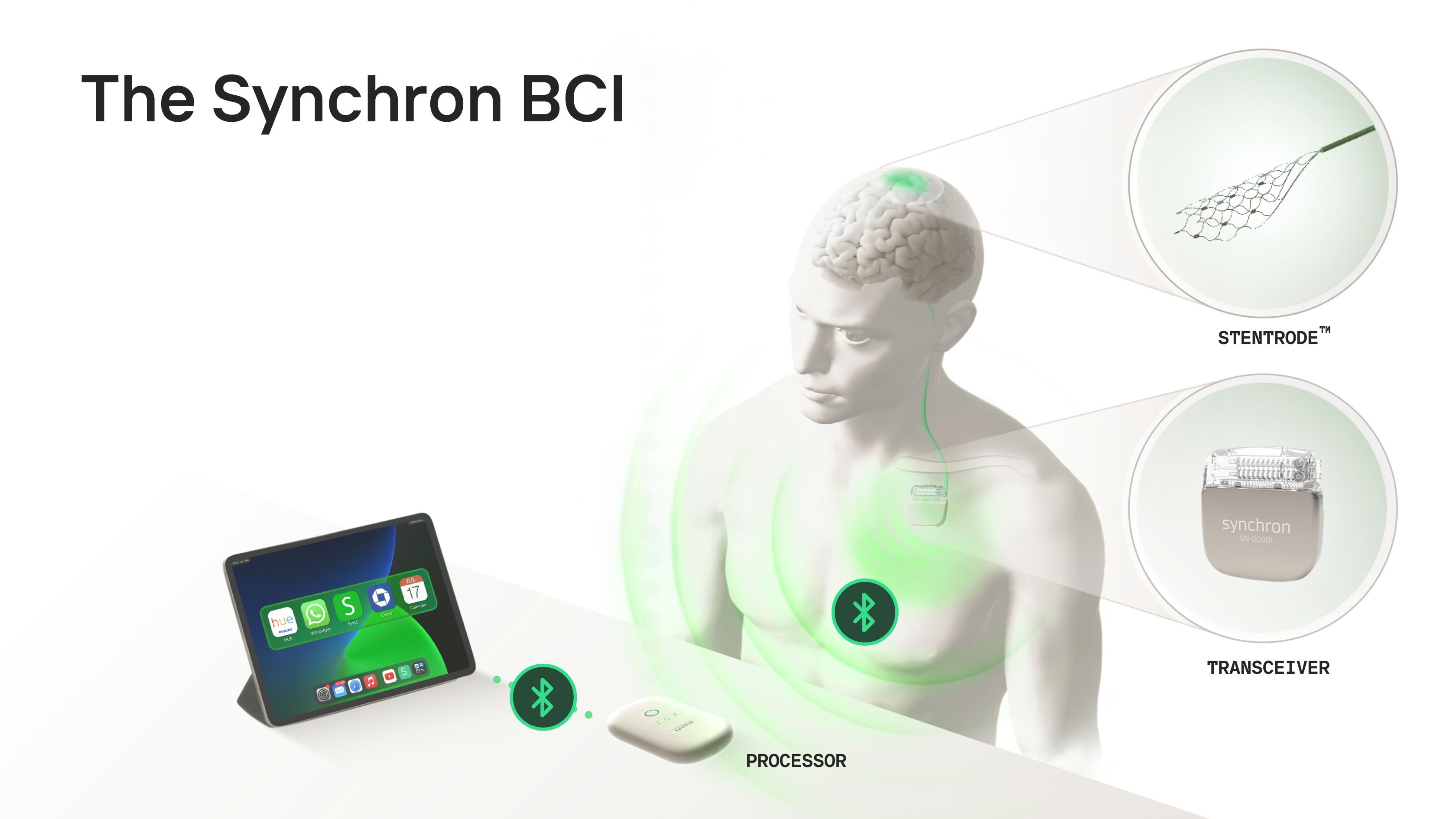 ilustracao-mostrando-funcionamento-da-bci-synchron