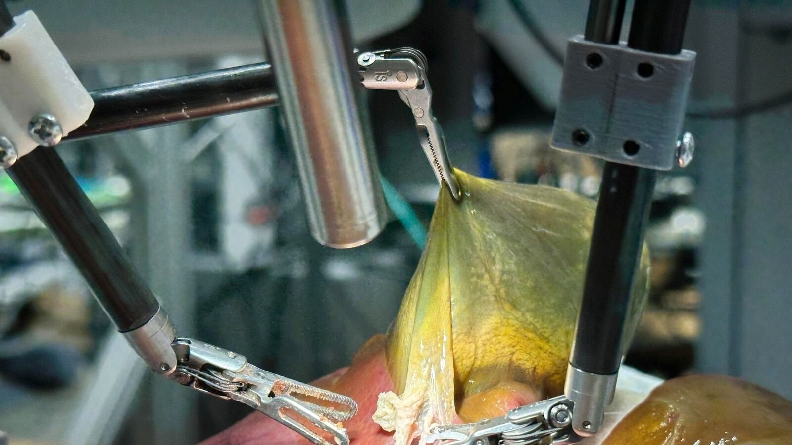 robo-faz-primeira-cirurgia-autonoma-em-orgao-humano