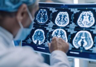 Parkinson pode ter início em órgão inesperado do corpo e não no cérebro, indica estudo na Nature